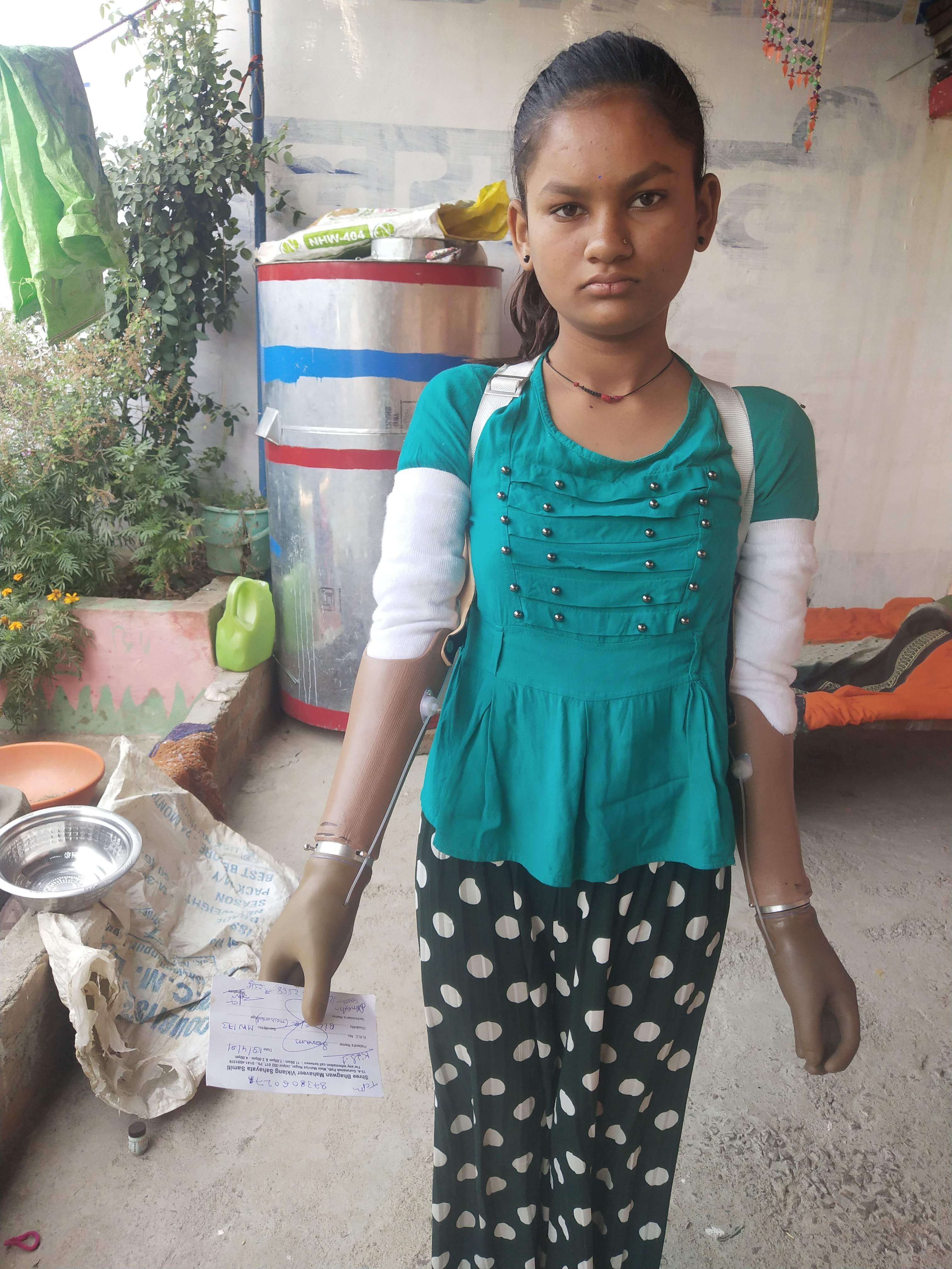 कृत्रिम दाहिने हाथ में कागज पकड़े सोनम राजपूत।