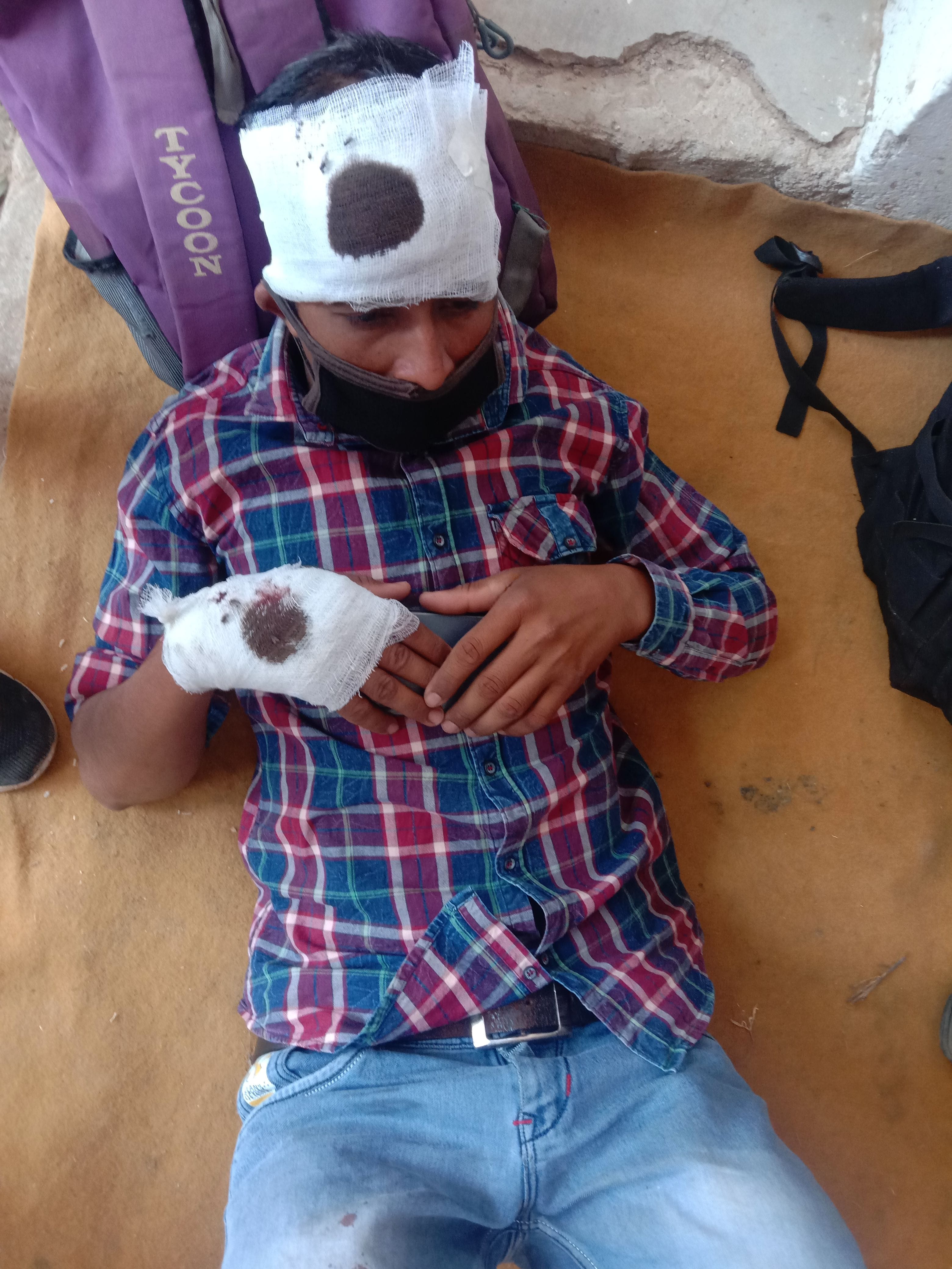 चुनाव ड्यूटी जाने के दौरान सड़क हादसे में घायल शिक्षामित्र मोहित कुमार। चुनाव ड्यूटी जाने के दौरान सड़क हादसे में घायल शिक्षामित्र मोहित कुमार।