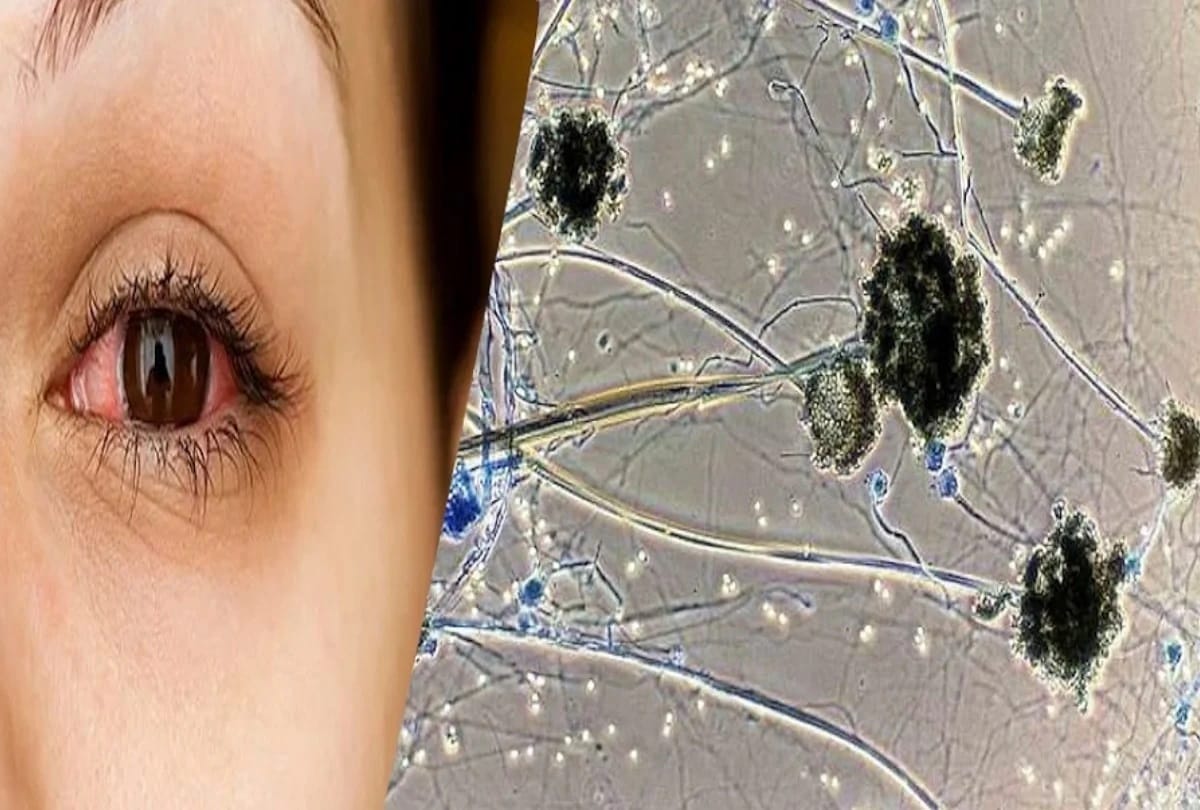 Black Fungus Infection Pib Fact Check Mucormycosis Symptoms And Treatment फ क ट च क क य इस घर ल न स ख ह सकत ह ब ल क फ गस क इल ज ज न व यरल व ड य क सच च ई Amar Ujala