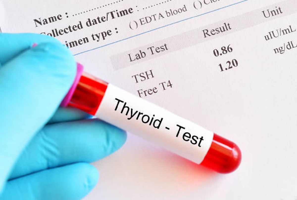 Thyroid Function Test Report Meaning Of T3 T4 Tsh Test सल ह थ यर यड म T3 T4 और Tsh ट स ट क क य मतलब ज न मर ज क स च क कर अपन र प र ट Amar Ujala