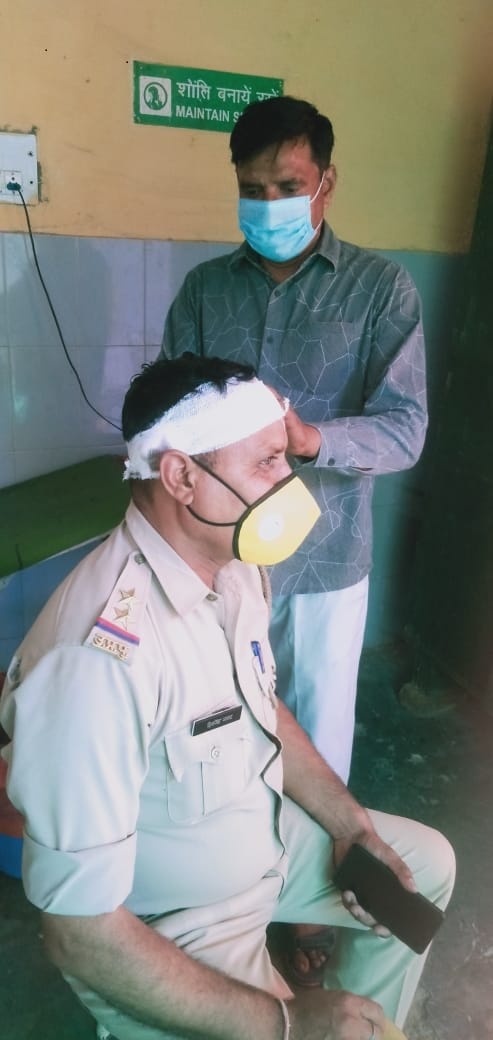 अलावलपुर गांव में पथराव में घायल दरोगा शिव सिंह। अलावलपुर गांव में पथराव में घायल दरोगा शिव सिंह।