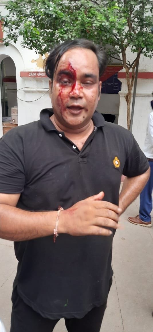 The bike rider was publicly thrashed after being hit, bled The bike rider was publicly thrashed after being hit, bled