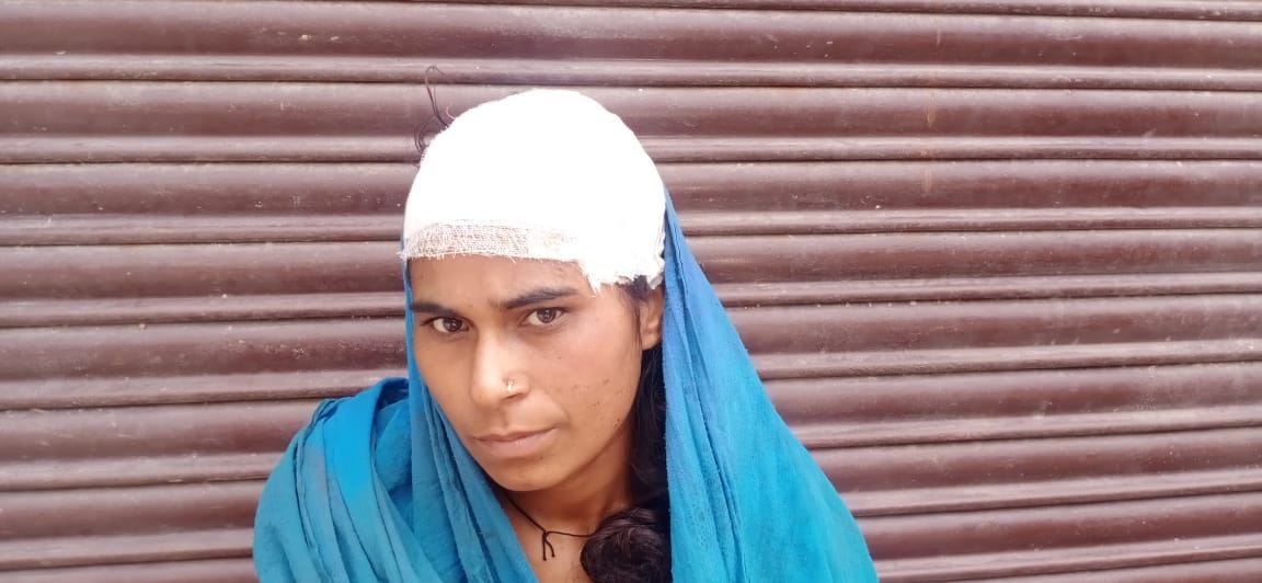 पथराव में घायल महिला। पथराव में घायल महिला।