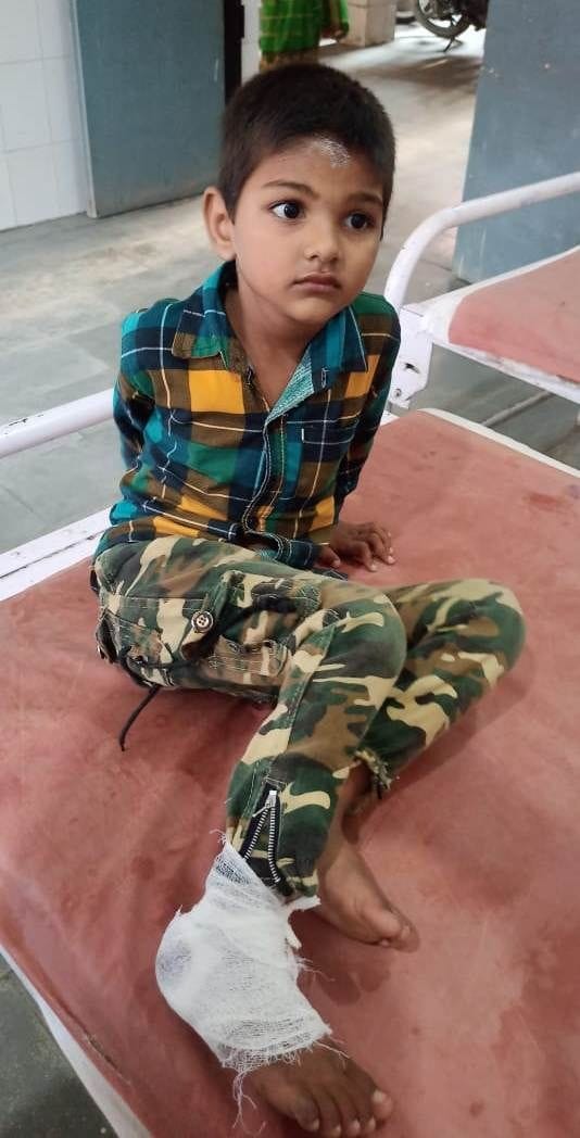 टीकैत बिसावर के पास मैक्स् की टक्कर से घायल बाइक सवार बच्ची कामिनी।