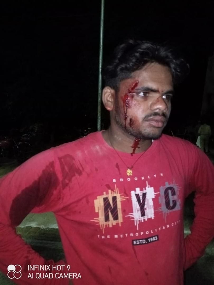 धिमरपुरा में हुई मारपीट में घायल धिमरपुरा में हुई मारपीट में घायल