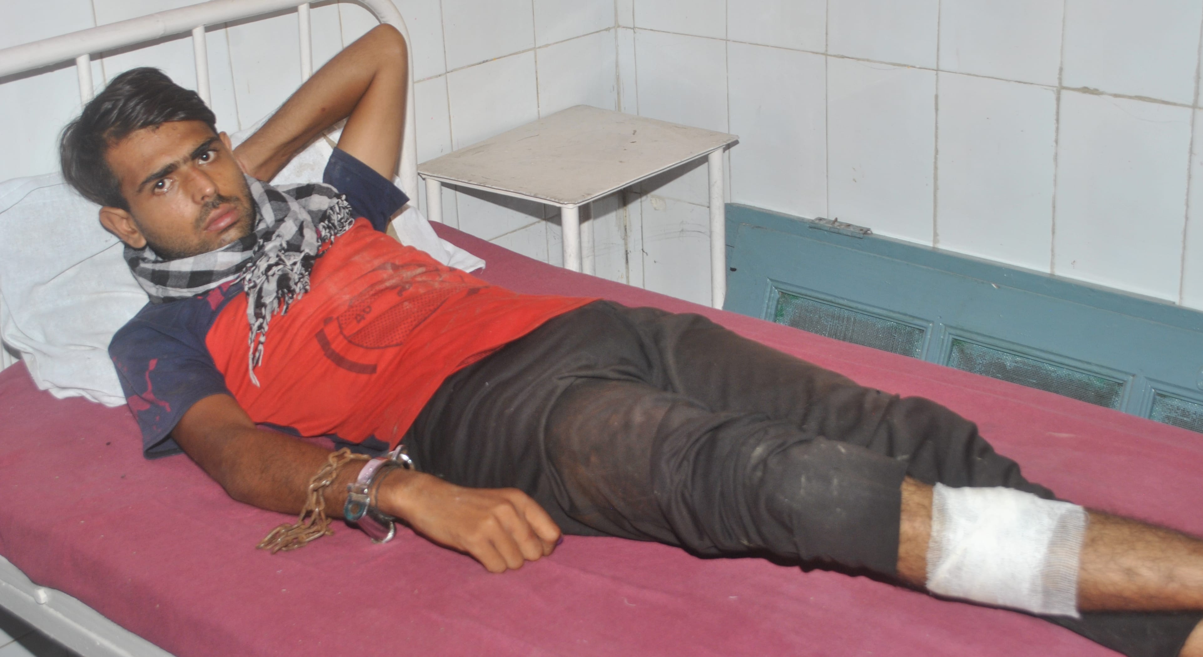शामली पुलिस मुठभेड़ में घायल बदमाश शामली पुलिस मुठभेड़ में घायल बदमाश
