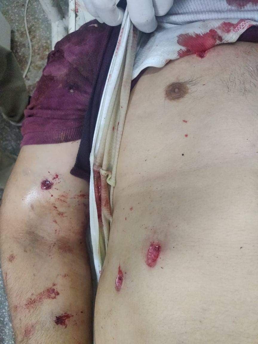 गुल्लर के शरीर पर गोलियों के निशान। गुल्लर के शरीर पर गोलियों के निशान।
