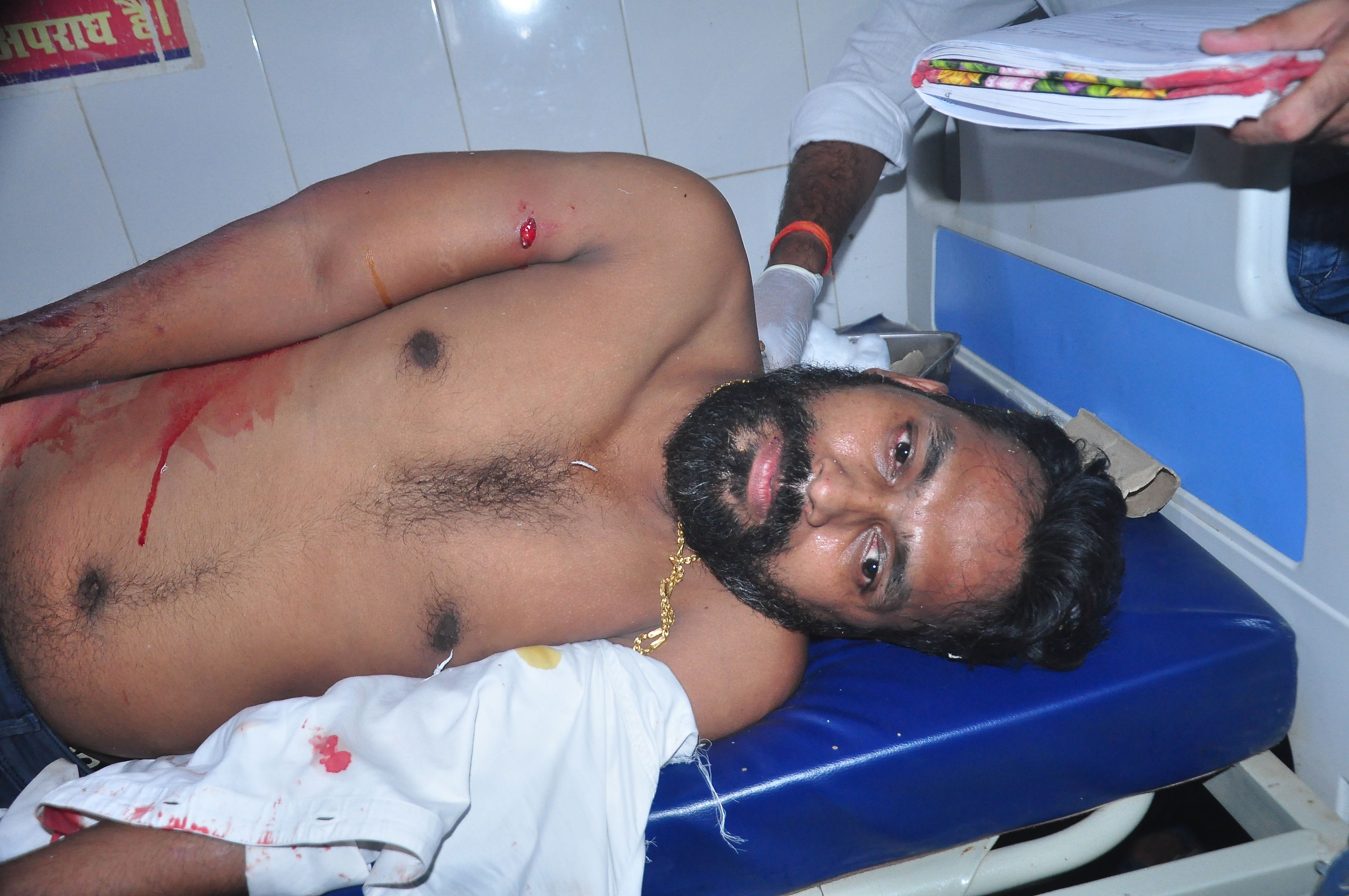 कंधई थाने के रखहा बाजार के समीप बदमाशों की गोली से घायल बाइक सवार युवक प्रेम कुमार। संवाद कंधई थाने के रखहा बाजार के समीप बदमाशों की गोली से घायल बाइक सवार युवक प्रेम कुमार। संवाद