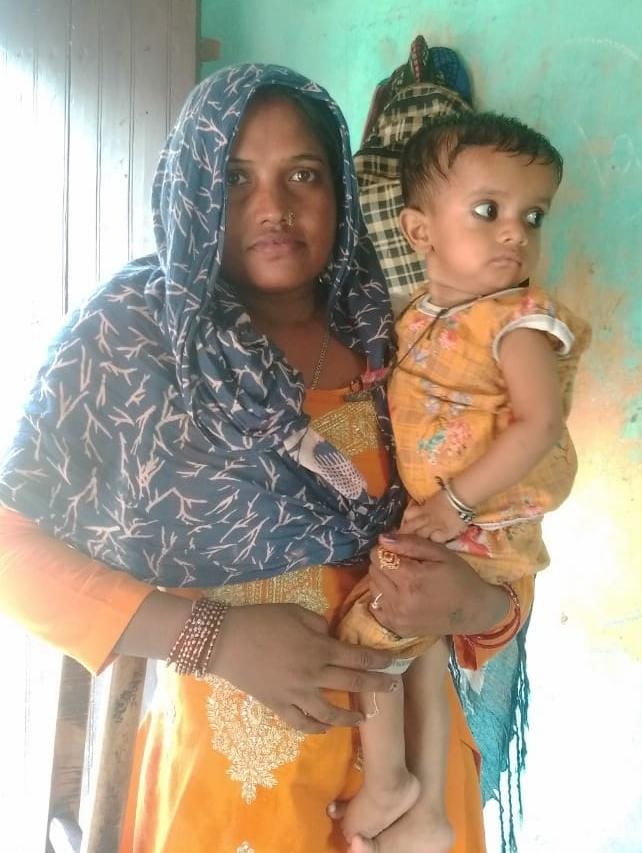 कुपोषित शिवाकांत के साथ उसकी मां रूकमेश
