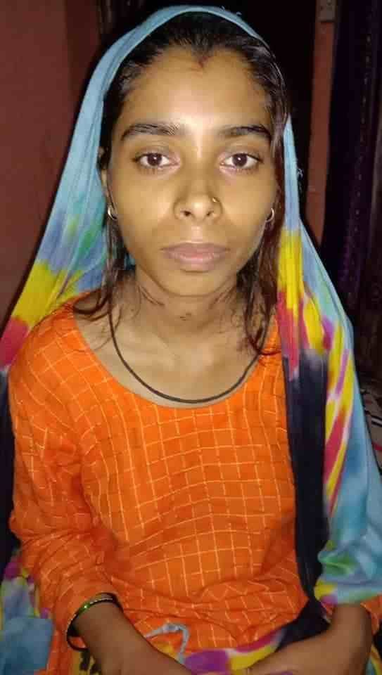 गले पर पड़े रस्सी के निशान को दिखाई पीजीआई में उपचाराधीन रूमा। संवाद गले पर पड़े रस्सी के निशान को दिखाई पीजीआई में उपचाराधीन रूमा। संवाद