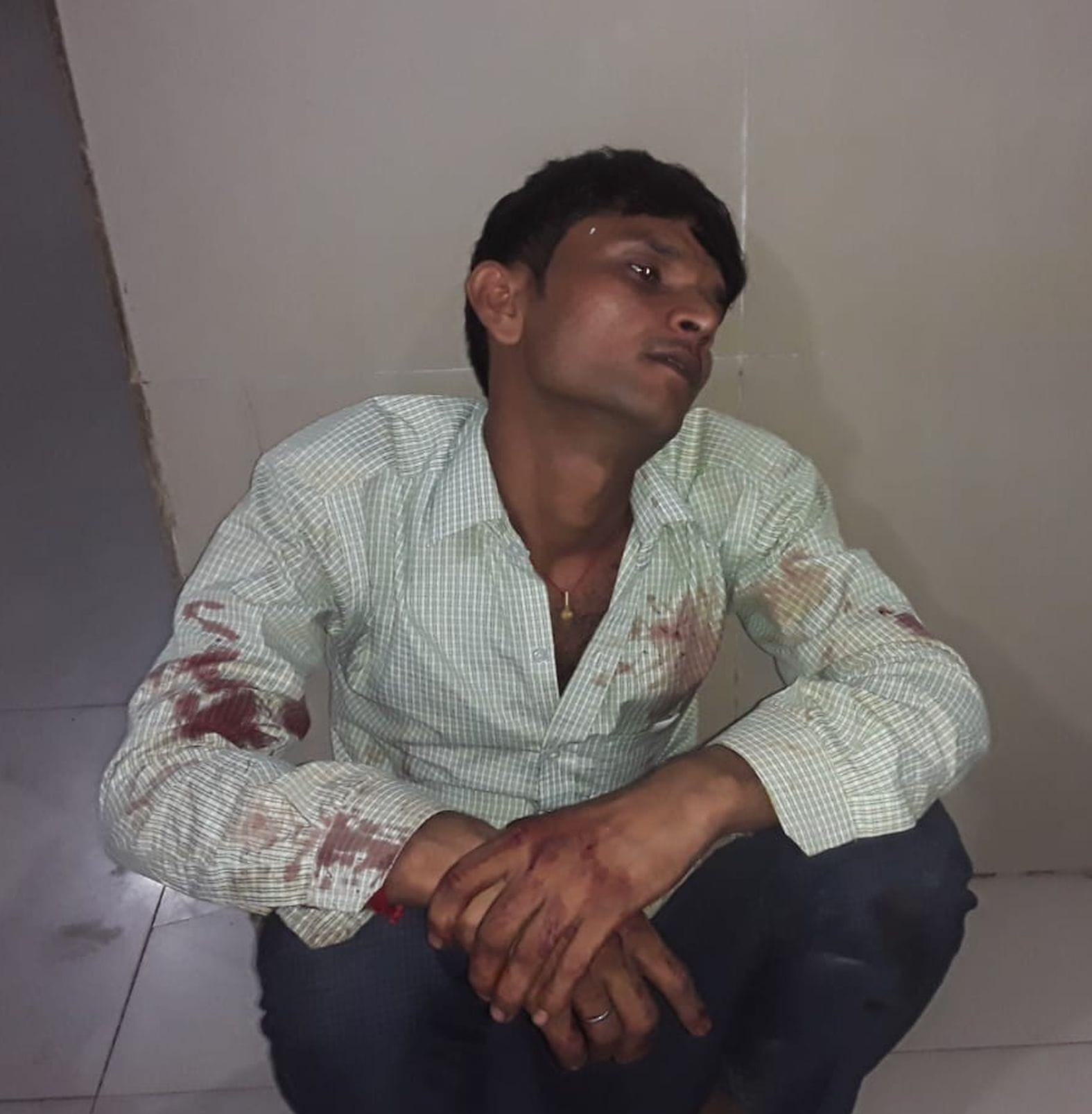 लोहिया अस्पताल की इमरजेंसी के बाहर बैठा घायल संदीप। संवाद