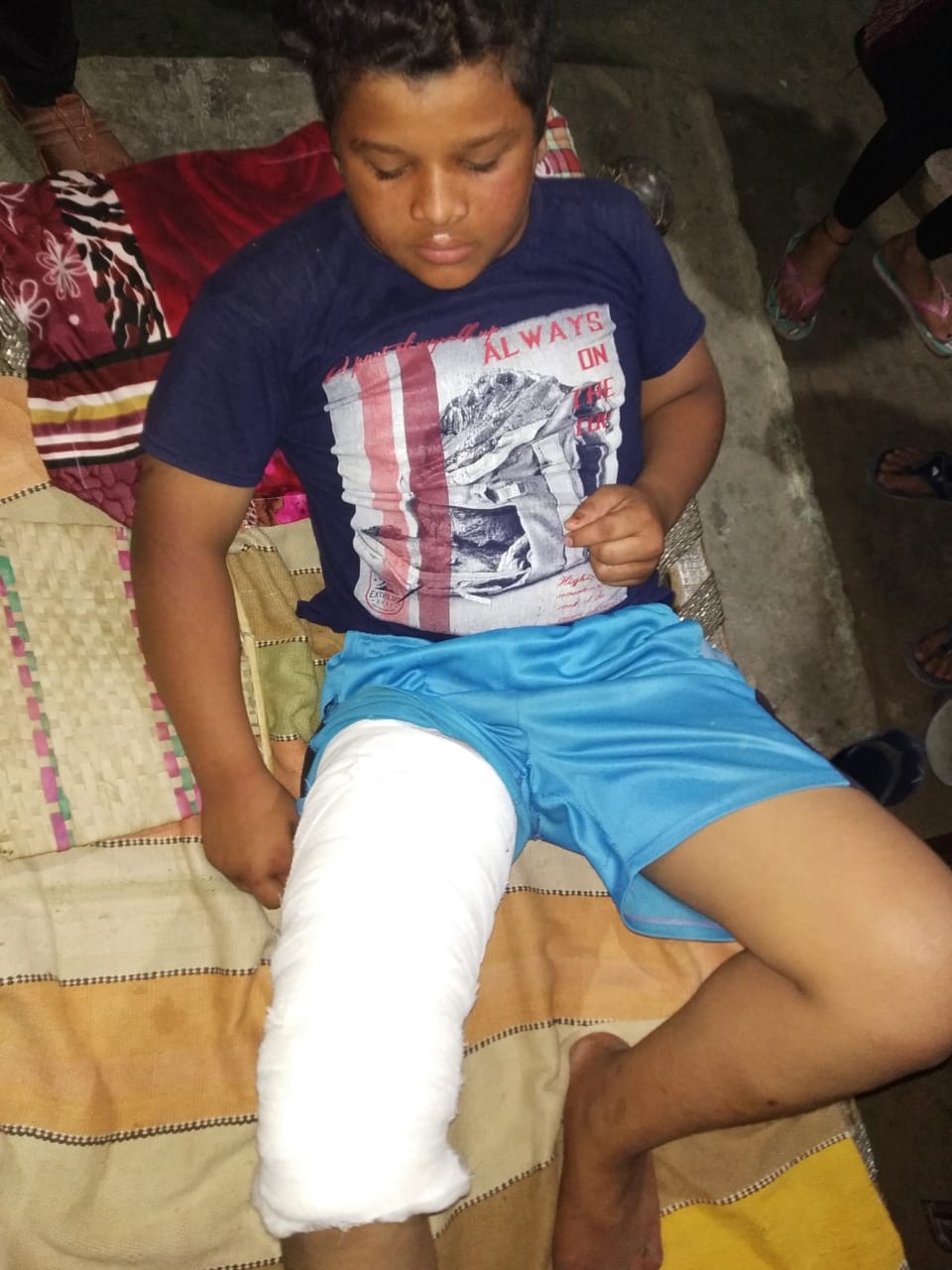 मीरापुर में गिरी दीवार की चपेट में आकर घायल हुआ बालक। मीरापुर में गिरी दीवार की चपेट में आकर घायल हुआ बालक।