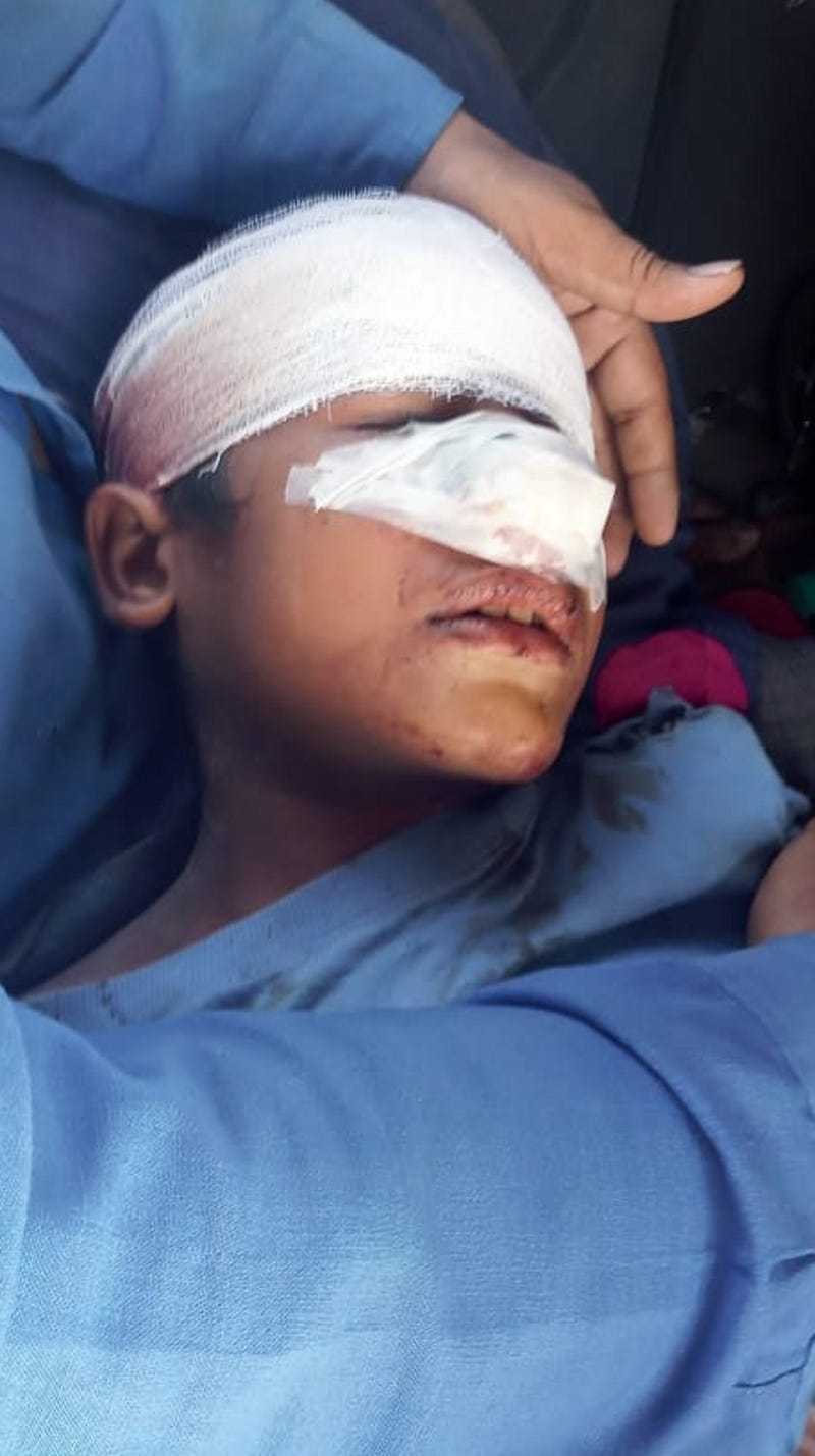 मीरापुर में गिरी दीवार की चपेट में आकर घायल बालक। मीरापुर में गिरी दीवार की चपेट में आकर घायल बालक।