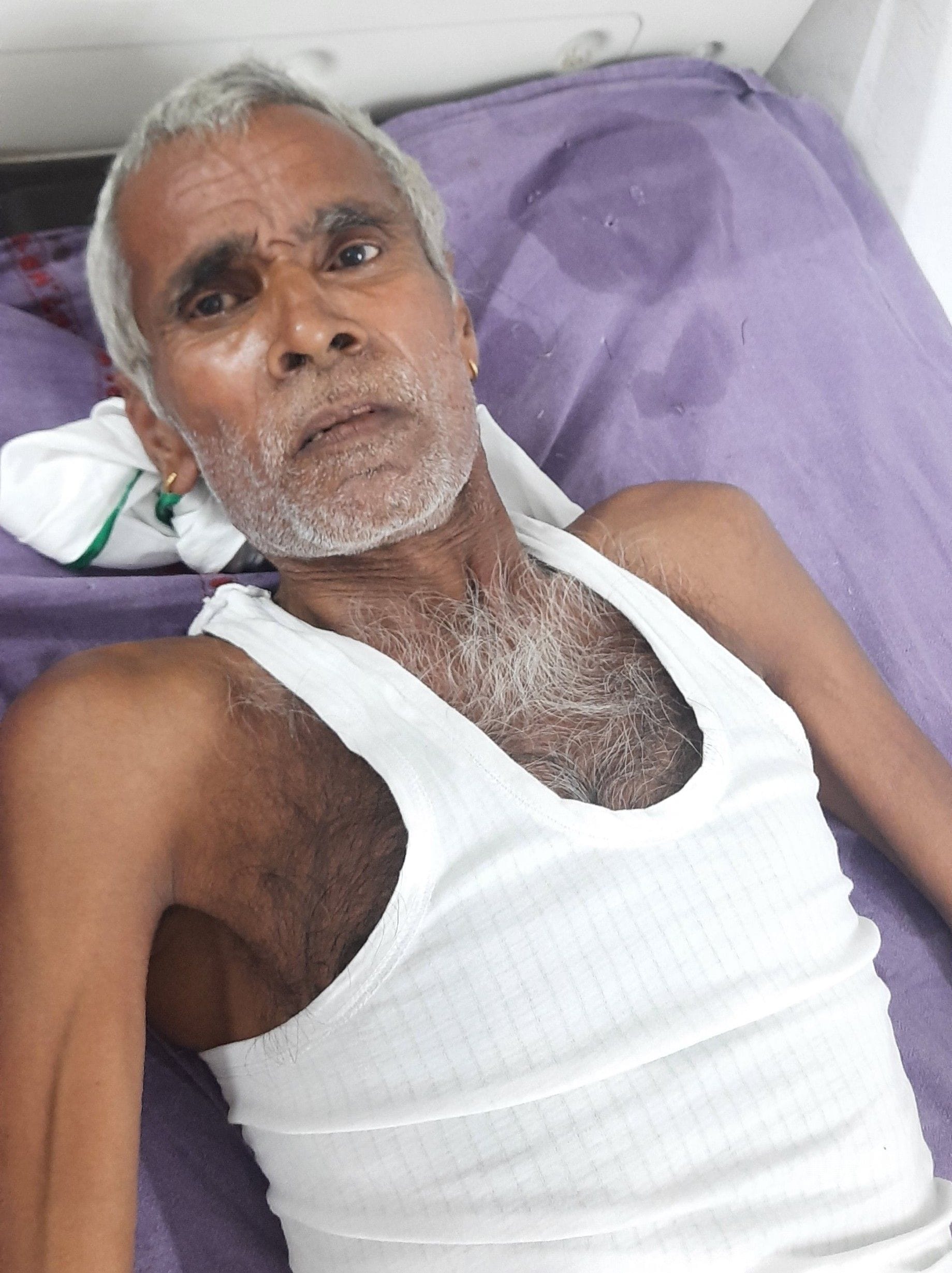बिजली गिरने से घायल हुआ गांव देवसर निवासी रामफल। संवाद बिजली गिरने से घायल हुआ गांव देवसर निवासी रामफल। संवाद