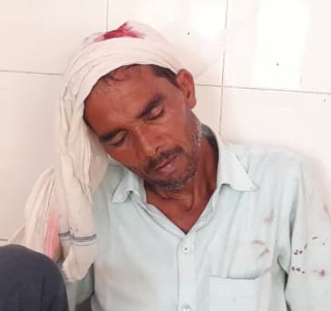 रहरा के बांसका खुर्द में मारपीट में घायल व्यक्ति। रहरा के बांसका खुर्द में मारपीट में घायल व्यक्ति।