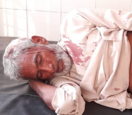 रहरा के बांसका खुर्द में मारपीट में घायल खुर्द। रहरा के बांसका खुर्द में मारपीट में घायल खुर्द।
