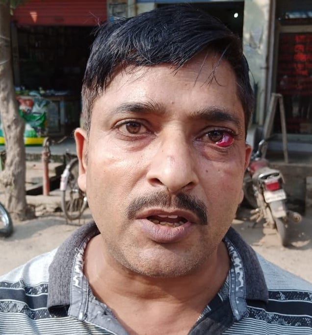 कांधला में हमले में घायल व्यापारी अमित। कांधला में हमले में घायल व्यापारी अमित।