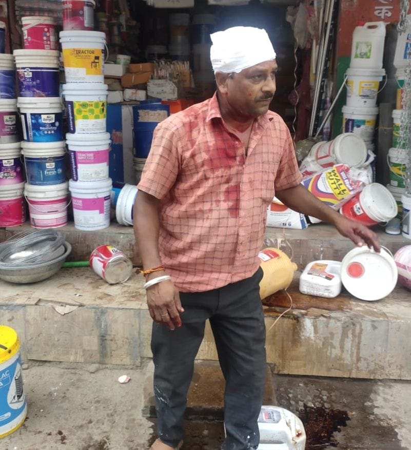 मारपीट में घायल व्यापारी। संवाद मारपीट में घायल व्यापारी। संवाद