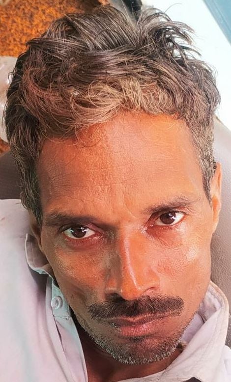 घायल शिवराज यादव। संवाद