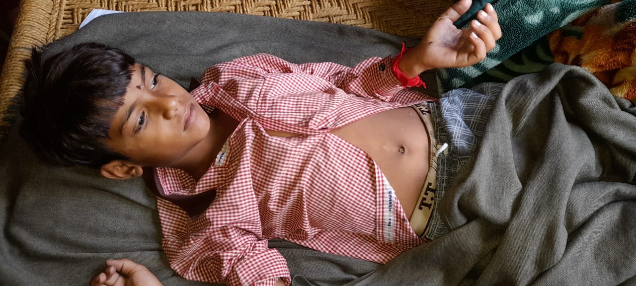 करंट से झुलसा निर्मल करंट से झुलसा निर्मल
