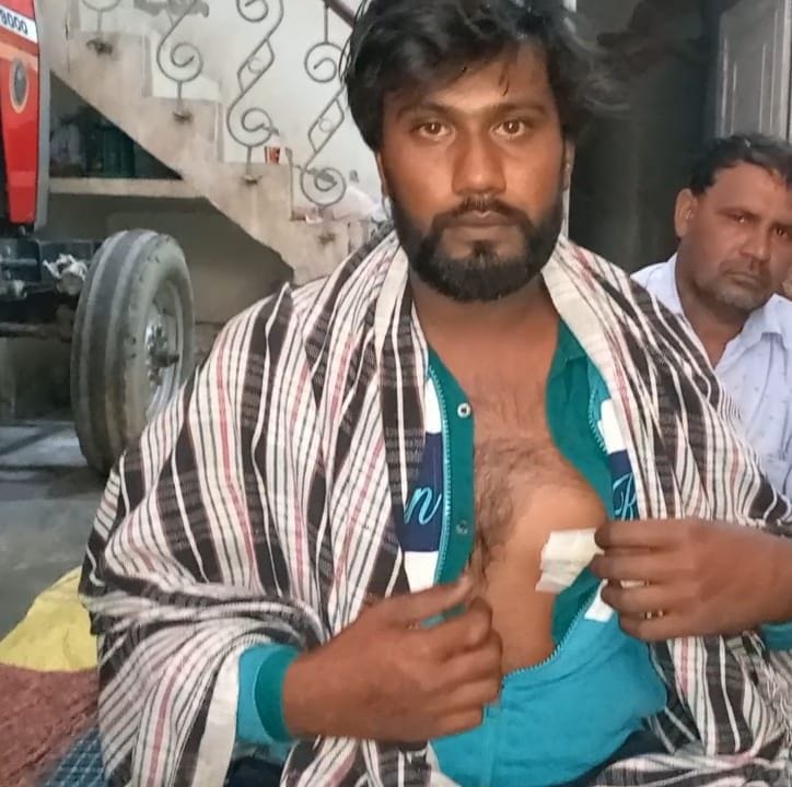 सैनीपुरा में हुई वारदात के बाद सीने पर लगे चाकू का घाव दिखाता सुमित। संवाद सैनीपुरा में हुई वारदात के बाद सीने पर लगे चाकू का घाव दिखाता सुमित। संवाद