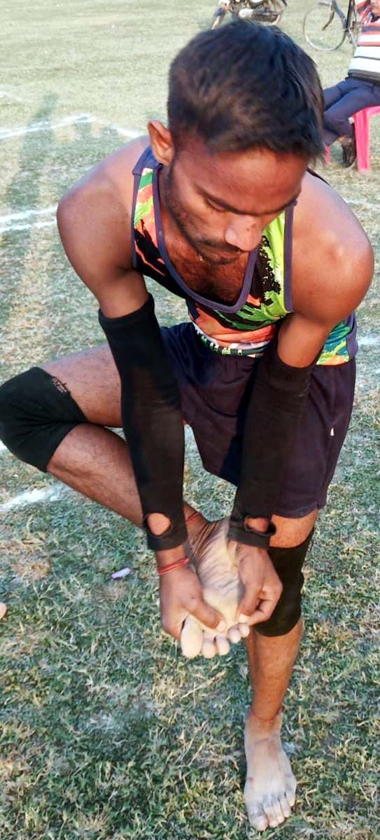 चोट दिखाते ददरौल के गांव अजीजगंज ददरौल के खिलाड़ी अभिषेक कुमार वर्मा चोट दिखाते ददरौल के गांव अजीजगंज ददरौल के खिलाड़ी अभिषेक कुमार वर्मा