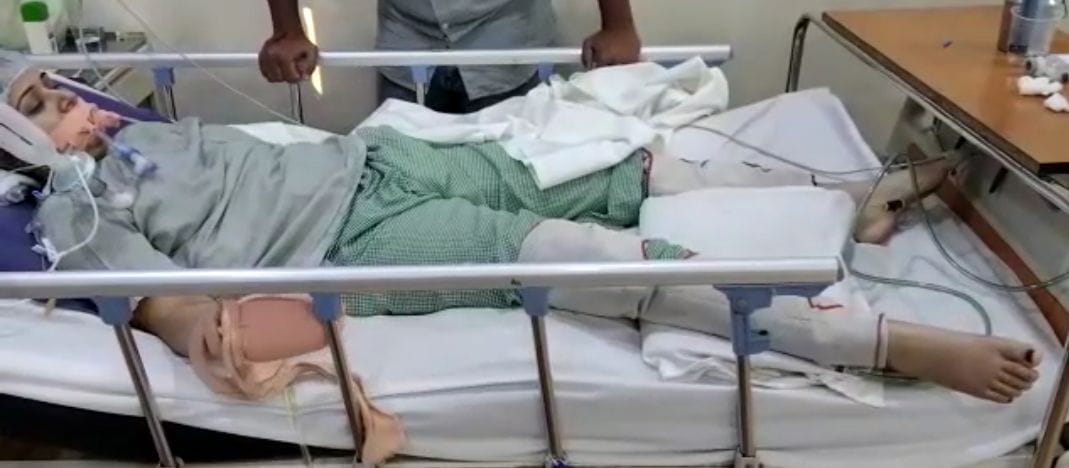 पानीपत। अस्पताल में उपचाराधीन पीड़ित ममता। पानीपत। अस्पताल में उपचाराधीन पीड़ित ममता।