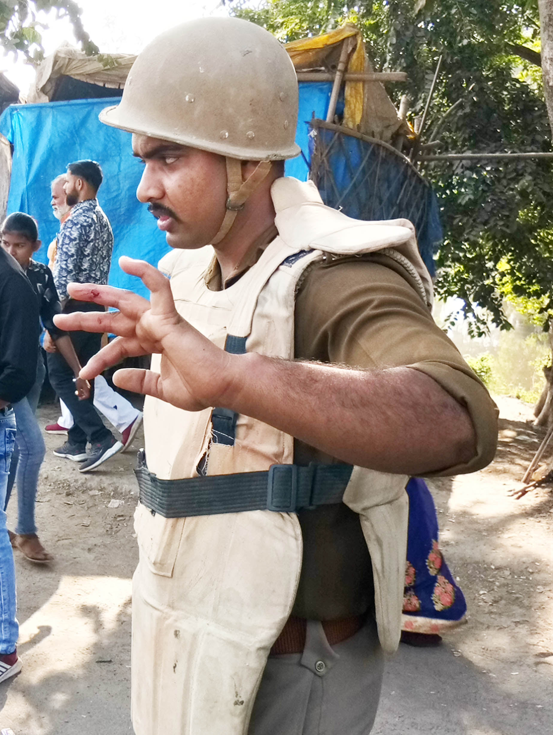 पीड़ित महिलाओं के डंडे से घायल सिपाही।