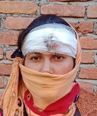 नशेड़ी युवकों ने महिला दुकानदार को घायल कर गल्ले में रखे रुपये लूटे