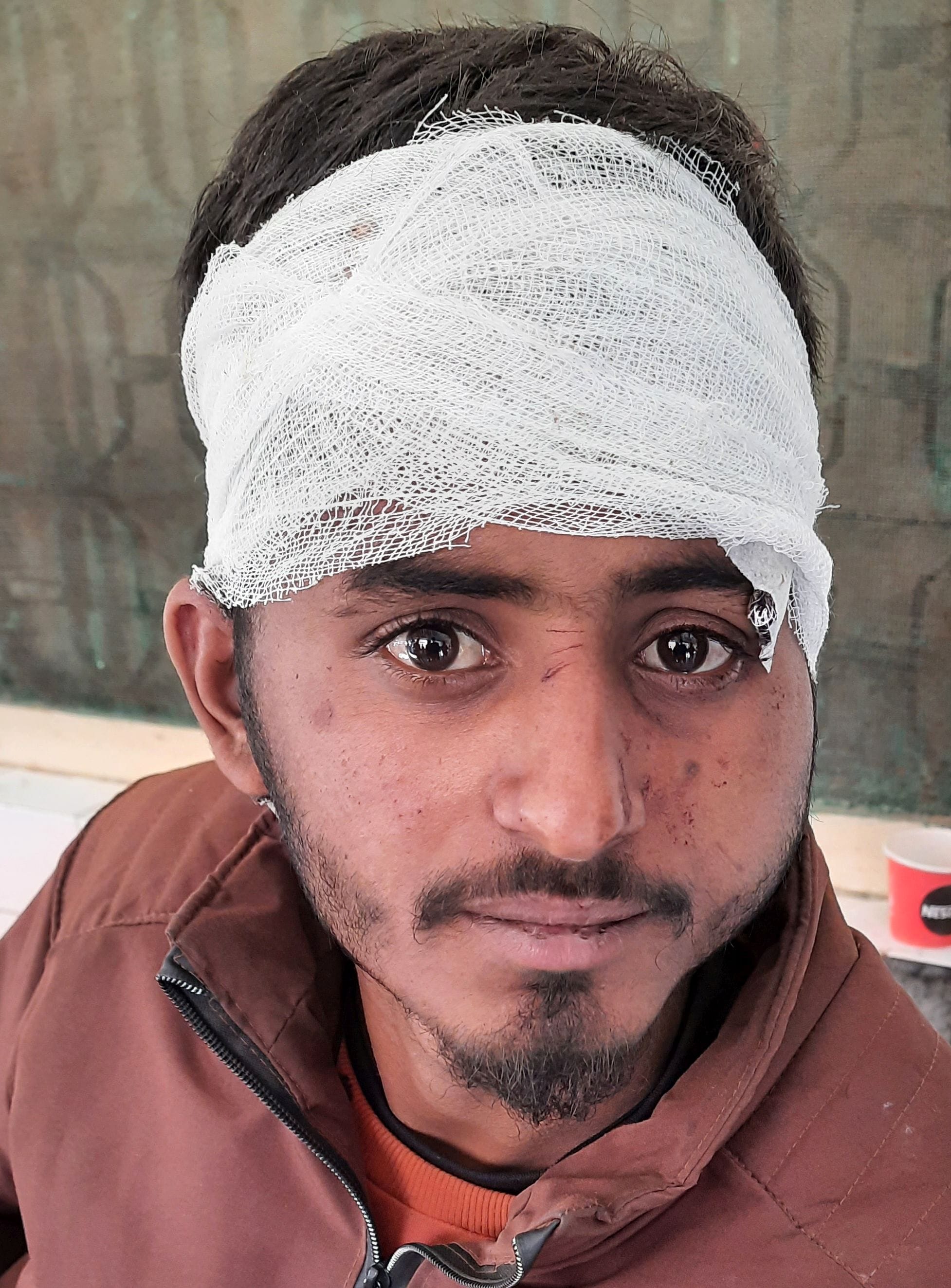 सड़क हादसे में घायल अशोक नाथ।