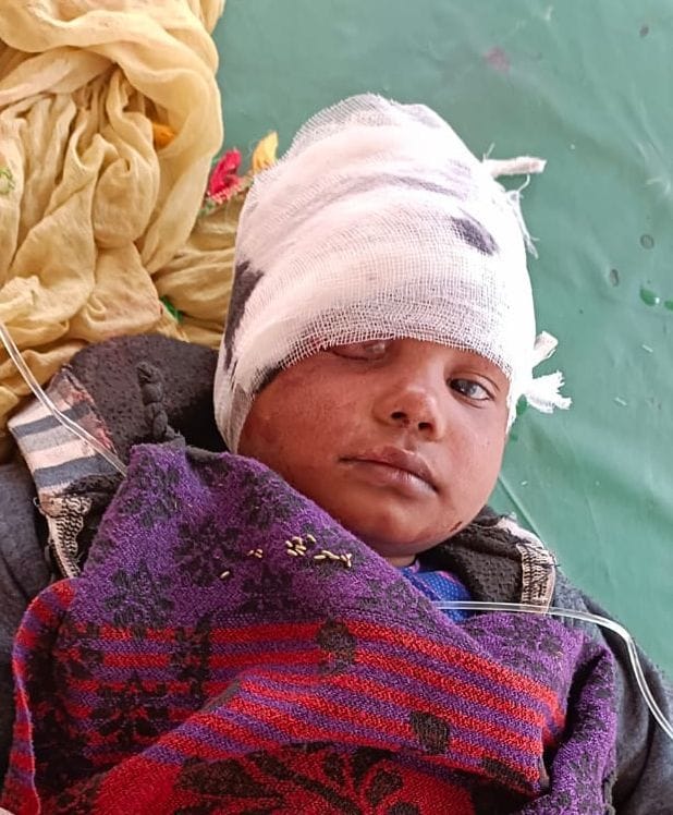 घायल पल्लवी। घायल पल्लवी।