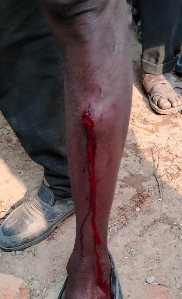 Police lashed sticks on farmers who came to collect urea Police lashed sticks on farmers who came to collect urea