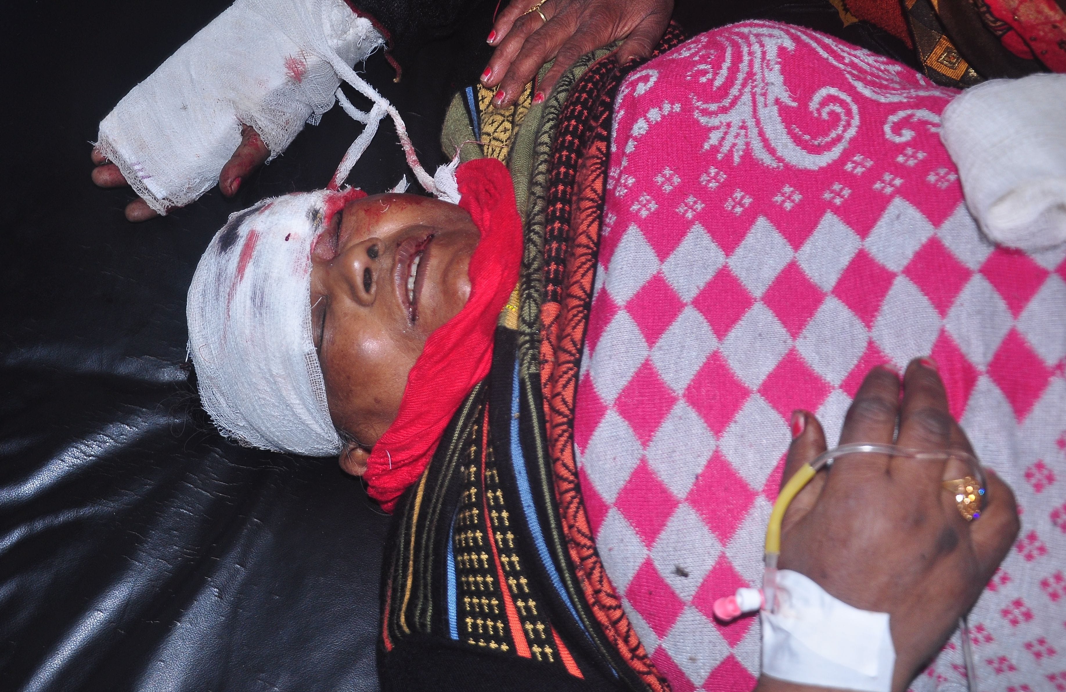 सड़क हादसे में घायल महिला शीला। संवाद