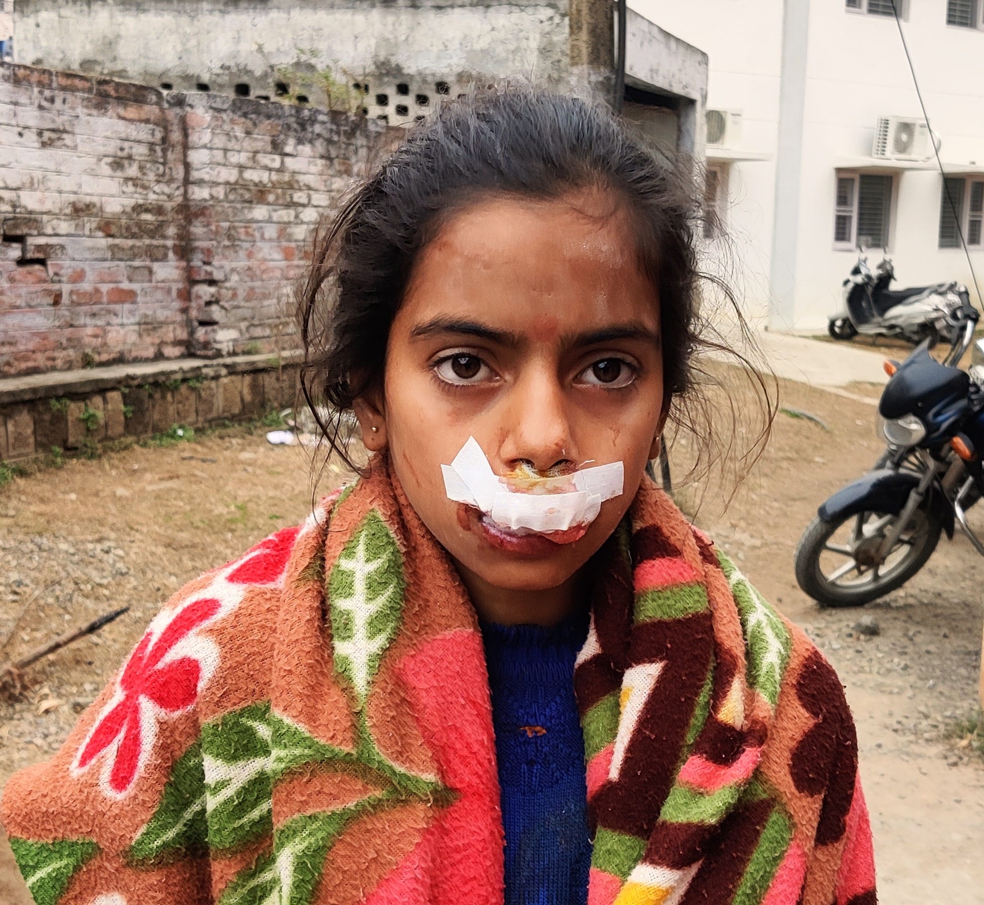 उधमपुर: जमीनी विवाद मैं घायल पिता और पुत्री जिला अस्पताल में उपचार दिन. उधमपुर: जमीनी विवाद मैं घायल पिता और पुत्री जिला अस्पताल में उपचार दिन.
