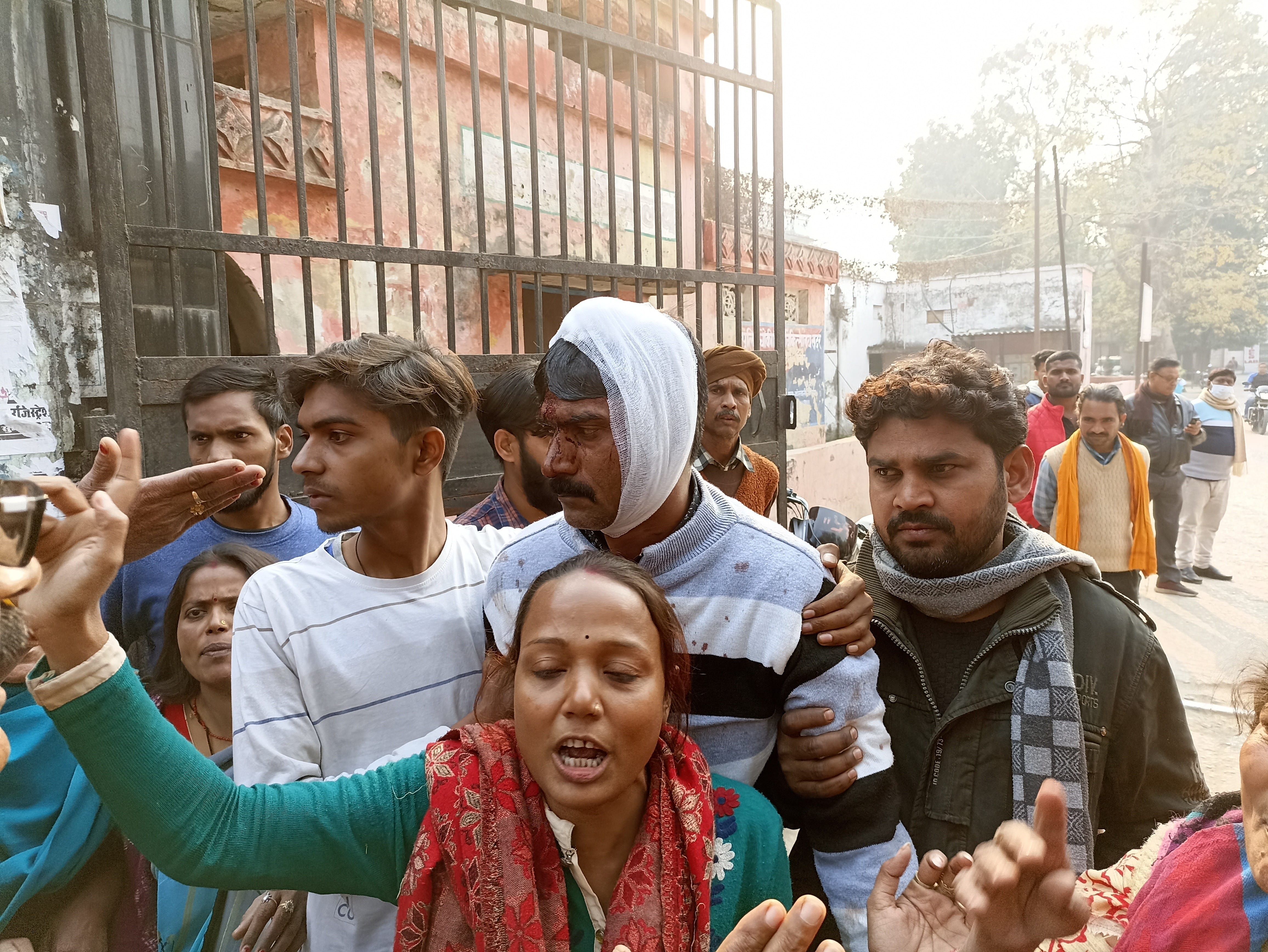 इशरतगंज में हुए मारपीट में घायल रविकांत। इशरतगंज में हुए मारपीट में घायल रविकांत।