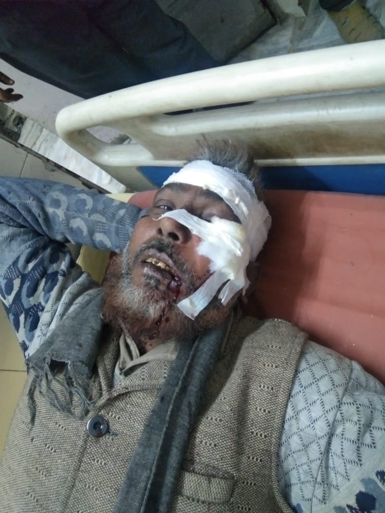 परतापुर जीवन सहाय में घायल चक्की मालिक रसीद खान  