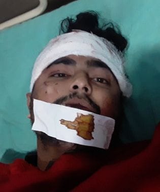 ोहिया में भर्ती नदीम। संवाद ोहिया में भर्ती नदीम। संवाद