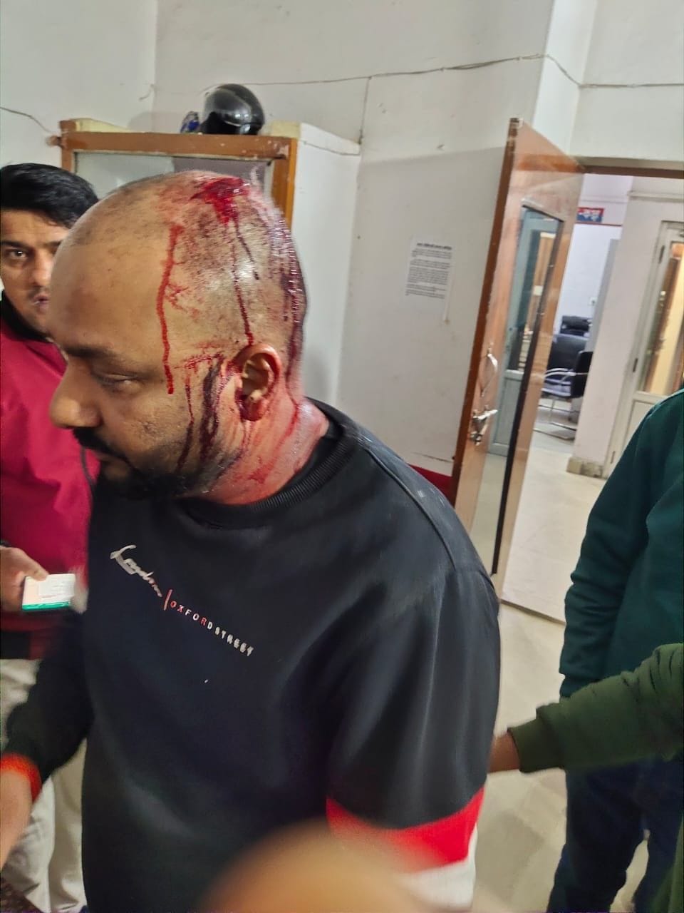गांधी नगर में हुई मारपीट में घायल विनय अग्रवाल। गांधी नगर में हुई मारपीट में घायल विनय अग्रवाल।