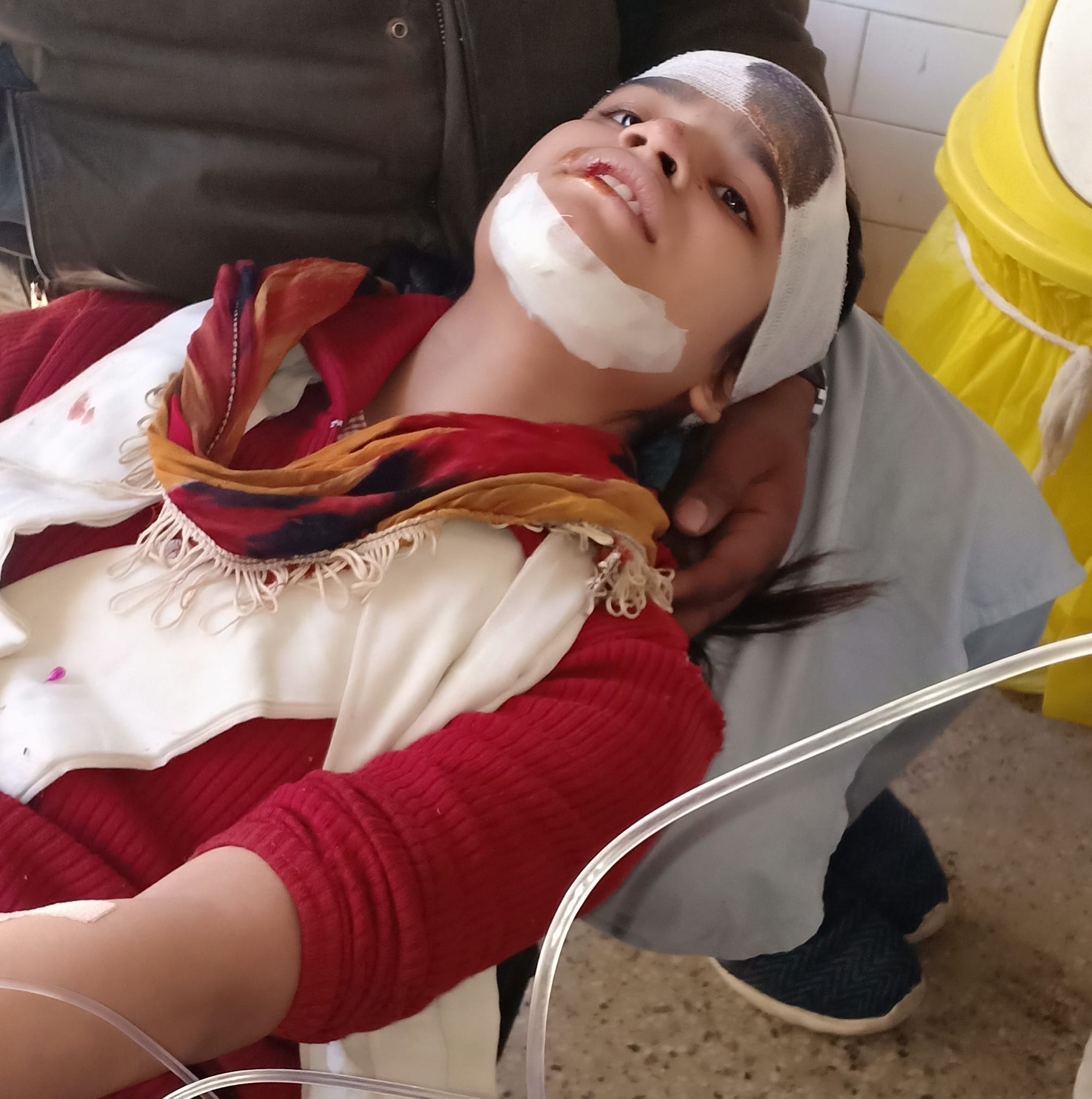 नगीना में सड़क दुर्घटना में घायल छात्रा। नगीना में सड़क दुर्घटना में घायल छात्रा।