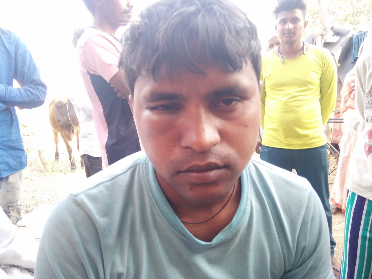 मुजफ्फरनगर : उत्तराखंड पुलिस की पिटाई से शिवकुमार की सूजी हुई आंख। मुजफ्फरनगर : उत्तराखंड पुलिस की पिटाई से शिवकुमार की सूजी हुई आंख।