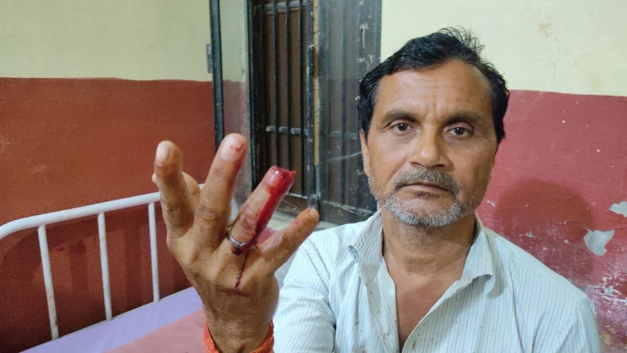 फोटो-11एयूआरपी-46 कटी अंगुली दिखाते घायल चाचा हरीनारायण। संवाद फोटो-11एयूआरपी-46 कटी अंगुली दिखाते घायल चाचा हरीनारायण। संवाद