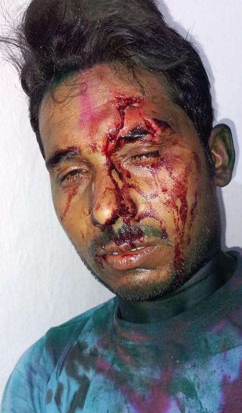 घायल अनिलेश सिंह। संवाद