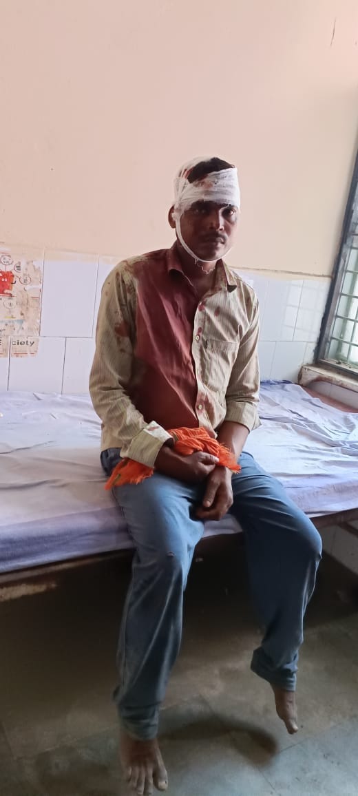 हलधरपुर थाना क्षेत्र के गुलौरी गांव में मारपीट में घायल भाजपा के बूथ अध्यक्ष सुनील कुमार राजभर। हलधरपुर थाना क्षेत्र के गुलौरी गांव में मारपीट में घायल भाजपा के बूथ अध्यक्ष सुनील कुमार राजभर।