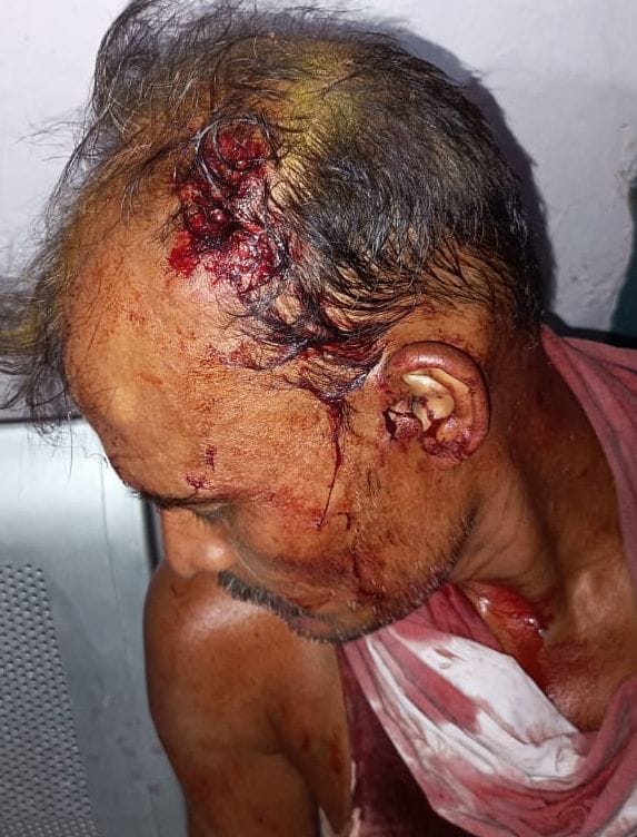 घायल अनुज कुमार सिंह। संवाद