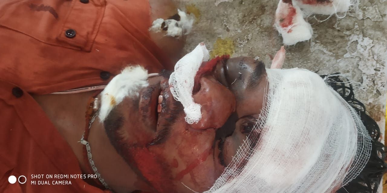 फोटो20एयूआरपी 23, 24 व 25- बाइक खड्ड में गिरने से घायल तीनों युवक