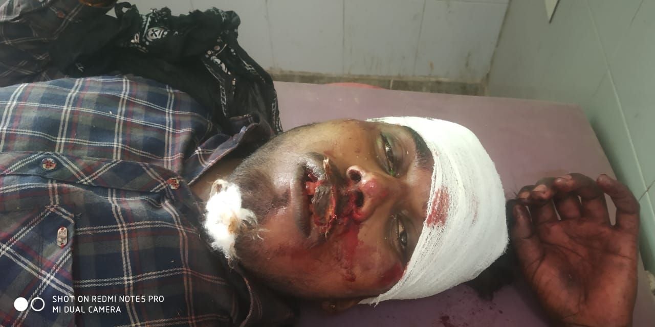 फोटो20एयूआरपी 23, 24 व 25- बाइक खड्ड में गिरने से घायल तीनों युवक