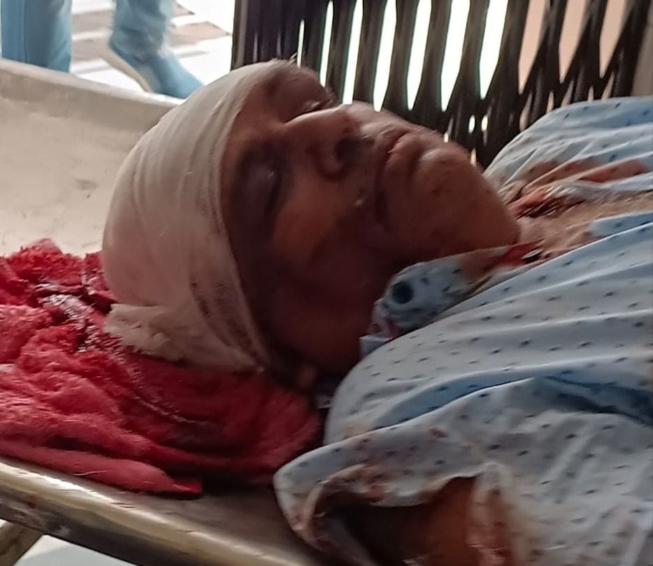 घायल अतुल अग्रवाल। घायल अतुल अग्रवाल।
