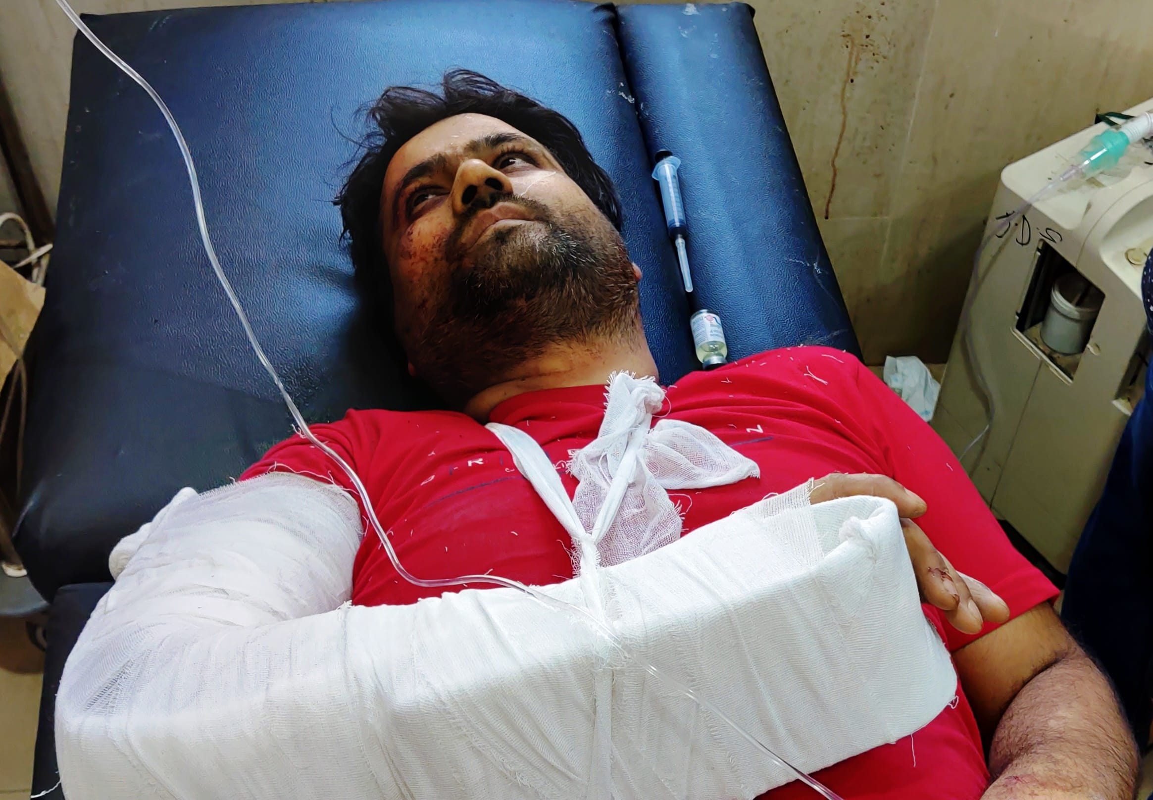 उधमपुर: जिला अस्पताल में उपचार दिन घायल लोग. उधमपुर: जिला अस्पताल में उपचार दिन घायल लोग.