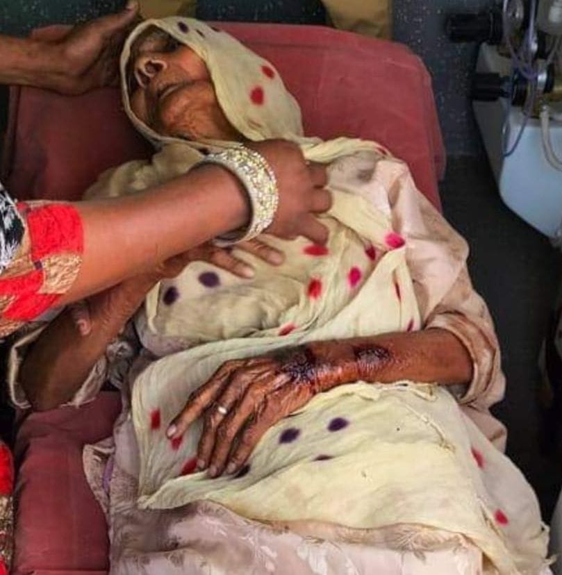 बाजपुर गांव कनोरी में आप की चपेट में आई मैंसर जहां।