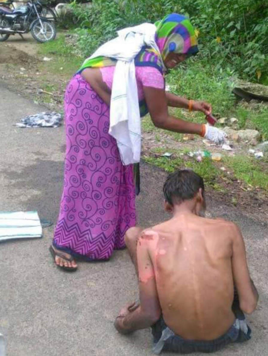 फुटपाथ पर लावारिस पड़े मरीज को नहलातीं फूला देवी। (फाइल फोटो) फुटपाथ पर लावारिस पड़े मरीज को नहलातीं फूला देवी। (फाइल फोटो)
